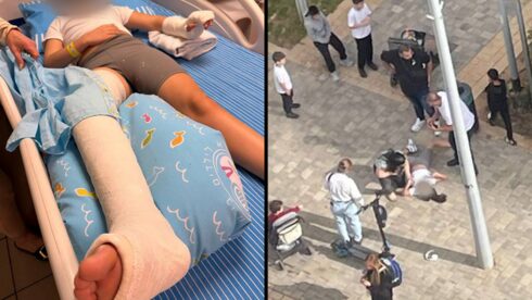 11-річна дівчинка серйозно постраждала від електросамоката в Ор-Єгуді: мати звинувачує владу в бездіяльності